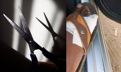 Zimbabwe Selling Toes