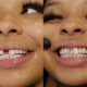 Chrisean Rock tooth