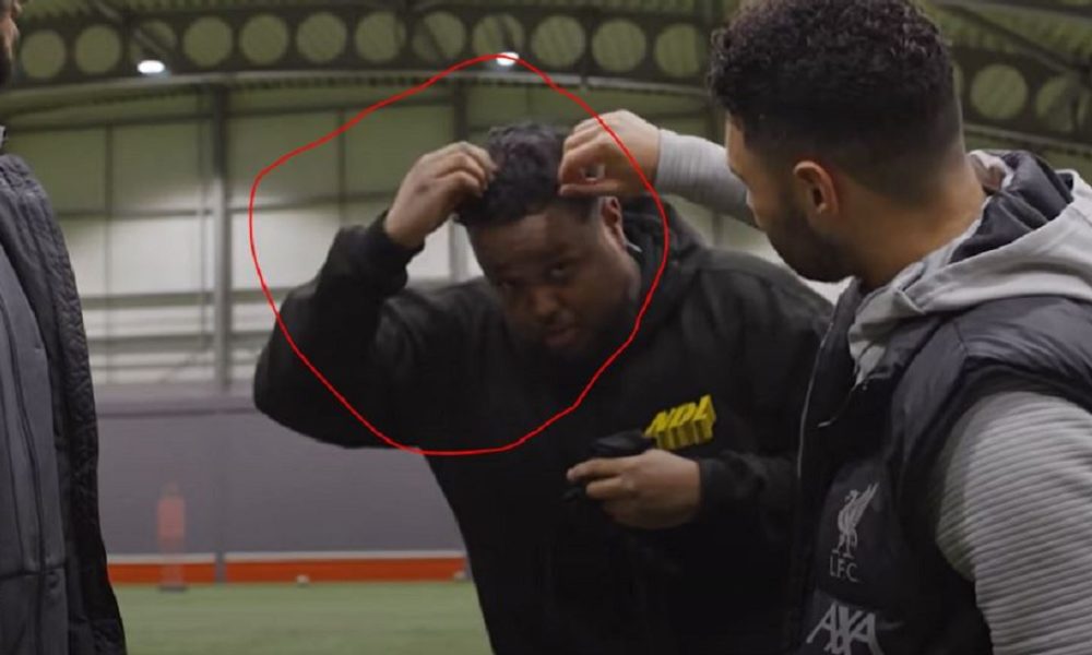 Chunkz Hairline