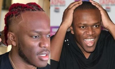 KSI Hairline