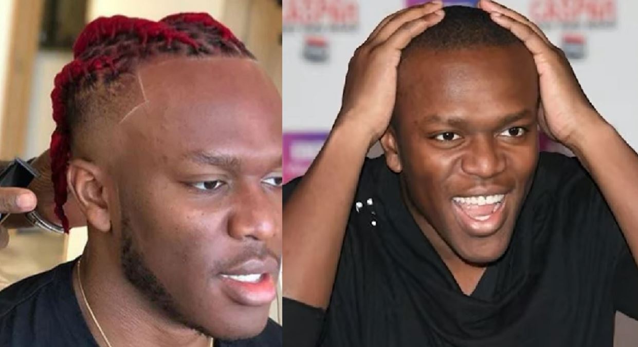 KSI Hairline