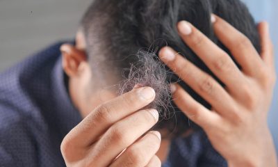 baldness