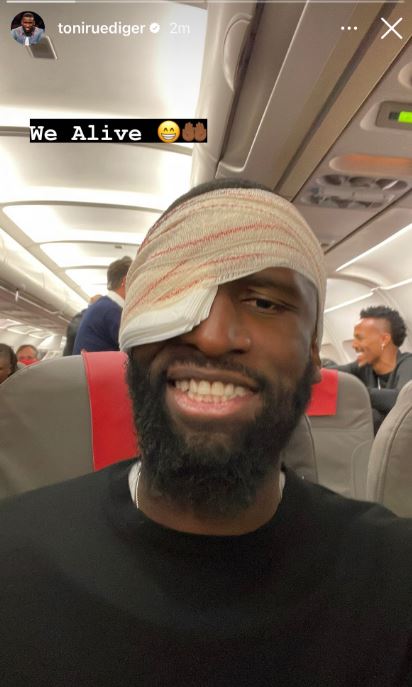 Antonio Rudiger Injury Update: Real Madrid star "Stitched Up" after covered in blood (Video) Antonio Rudiger Injury